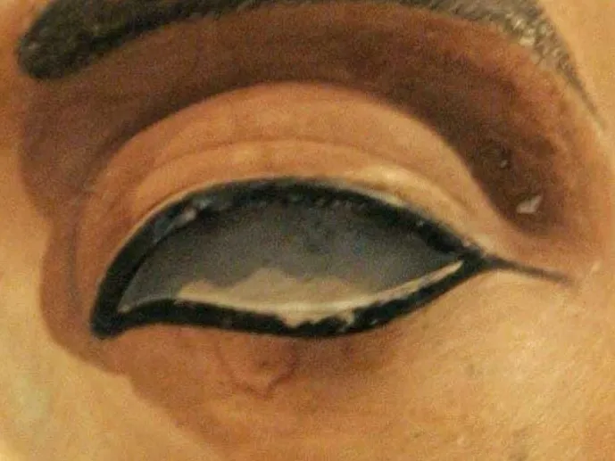 От­сутс­твие ле­вого зрач­ка